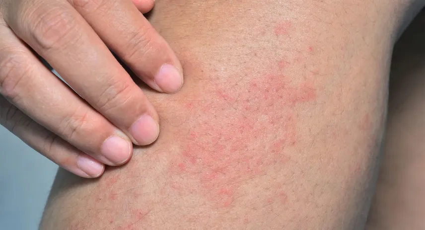 Can Carpet Cleaning Make you Sick: Things you Need to Know